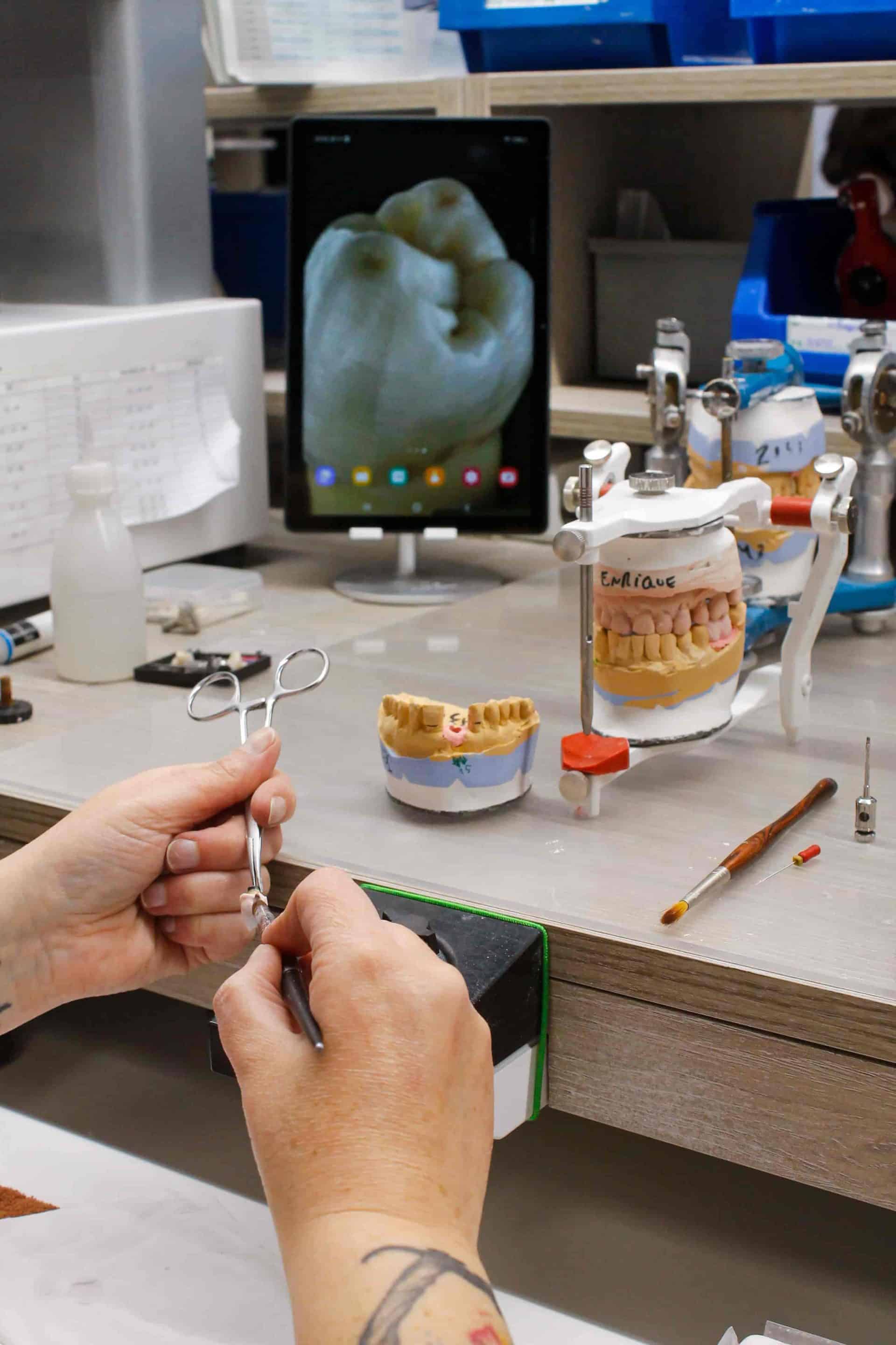 laboratorio dental en asturias